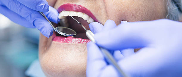 Best Emergency Treatment for Dental Infections or Abscesses in Dubuque, IA